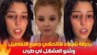 بحرقة شيماء كاتحكي جميع التفاصيل وشنو المشكل لي وقع ليها مع إحسان