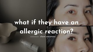 How to prevent an allergic reaction from eyelash extensions #lashtips