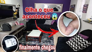 MEU BEBÊ PEGOU A DOENÇA MÃO-PÉ-BOCA😭/ Chegou comprinha da Shopee/ Vlog.