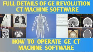 BASICS DETAILS OF GE REVOLUTION CT SOFTWARE #HOW TO OPERATE GE CT MACHINE SOFTWARE