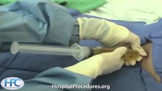 Paracentesis Procedure Video Trailer