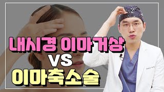 내시경이마거상 vs 이마축소수술 차이점은?