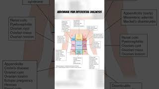 Stomach pain #medicalstudent #medstudentlife #anatomy #bodyfacts #pain #health #healthy #stomach