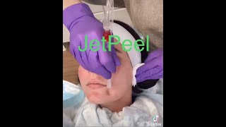 JetPeel