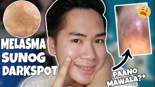 MELASMA SA MUKHA PAANO MAWALA? MADALING SOLUSYON PARA SA MELASMA!❤️