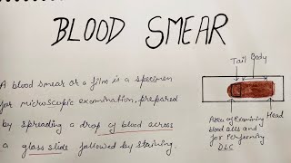 BLOOD SMEAR OR BLOOD FILM