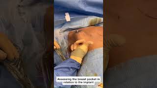 Patient Journey: Mid 20's Breast Augmentation Transformation