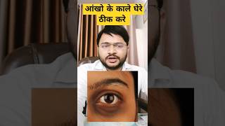 आंखो के काले घेरे जड़ से खत्म|| #trendingshorts #trending #viral #eyeshadow #youtubeshorts #halthy