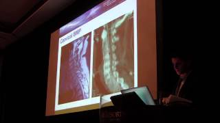 Annual Symposium 2013 | Dr. Villavicencio | Current Trends & Controversies in Biologics