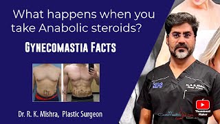 Anabolic Steroids and Gynecomastia | Male Breasts