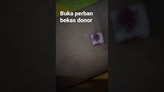 buka perban bekas donor darah tadi siang  #shorts