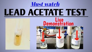 Lead acetate test | Test for sulfur containing amino acids | #Biochemistry | #NEETPG