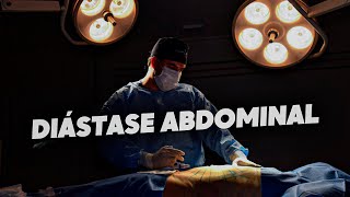 CONHEÇA A CORREÇÃO DA DIÁSTASE ABDOMINAL E PERCA A BARRIGUINHA! 🔥🤩 - Dr. Edson Neto