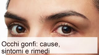 Occhi gonfi: cause, sintomi e rimedi