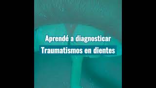 Tratamiento de Dientes Traumatizados / Curso ONLINE