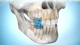 Séquence d'éruption des dents