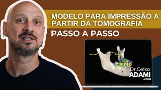 COMO CRIAR MODELOS 3D A PARTIR DE UMA TOMOGRAFIA UTILIZANDO O BLUESKY PLAN E O MESHMIXER