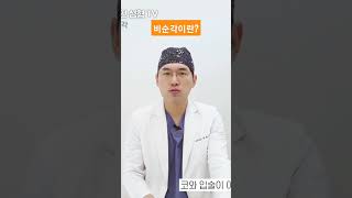 #비순각 #비순각수술 #코성형