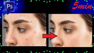 Photoshop Tutorial: How to Quickly Smooth Skin and Remove Blemishes & Scars✔ SMART T&P TECH