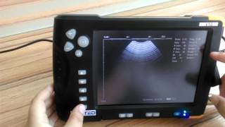 V10 ultrasound operation guideline