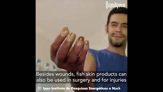 Gigadgets Unveils How a Fish Skin Can be Used To Treat Skin Burn