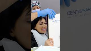 CROWNS AND VENEERS BEFORE AND AFTER | DENTAL IMPLANTS | SMILE DESIGN TURKEY | DENTIST TURKEY |