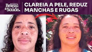 O ÓLEO ESSENCIAL que clareia e estica a pele, reduz manchas e rugas rapidamente