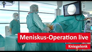 Kniegelenk: Meniskus-Operation live!