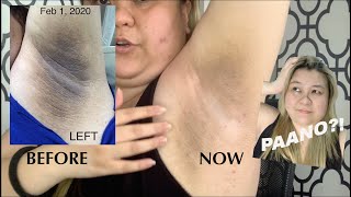 PROPER USE AND UPDATE ABOUT 88 TOTAL WHITE UNDERARM CREAM