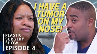 No More Nose Tumor || Beyond the Surface (S1 Ep4)