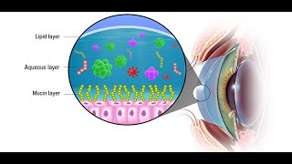 MGD-Associated Dry Eye: Pathophysiology and Therapies for Better Outcomes