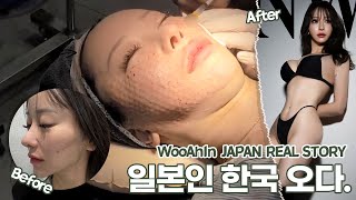 일본 유명 인플루언서가 우아인 성형외과에? 🇯🇵