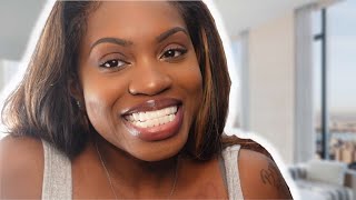 Shiny Smile Veneers Honest Review