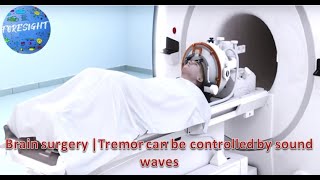 ब्रेन सर्जरी|कंपन को ध्वनि तरंगों से नियंत्रित किया जा सकता है |Tremor can be control by sound waves