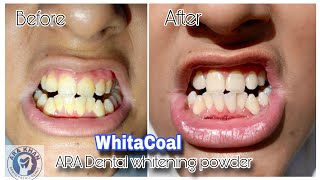 WhitaCoal (Teeth whitening product)