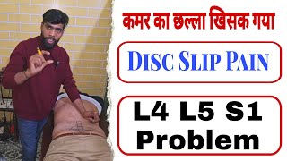 कमर का छल्ला खिसक गया : Disc Slip Pain  : L4 L5 S1 Problems : Helloupchar