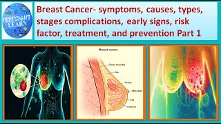 Breast Cancer symptoms, causes,types, complications,stages,early signs, risk factor,treatment part-1