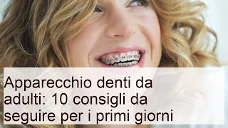 Apparecchio denti da adulti: 10 consigli da seguire