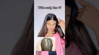 Try this hack ✅ to hide your wide scalp line ‼️ #hairhacks #hairtips #explore #ytshorts #shorts