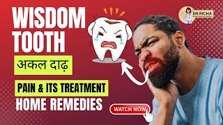 अक्कल दाढ़ दर्द के घरेलू उपाय और इलाज || Wisdom Tooth Pain Treatment & Home Remedies