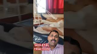 Skeletal traction