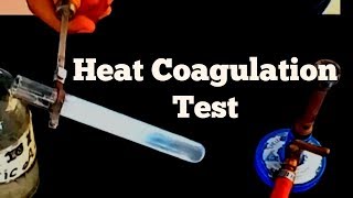 Heat coagulation test || Detection of albumin || #Biochemistry