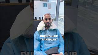 Hair Transplant Result After 10 Days - My Hair Transplant Experience