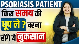 Psoriasis Patient के लिए गर्मियों की धूप फायदेमंद है या नुकसान | Psoriasis Me Vitamin D  Ke Fayde