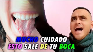 ESTO SALE DE TU BOCA, ES TIEMPO  DE EXAMINAR LO QUE SALE TU LENGUA