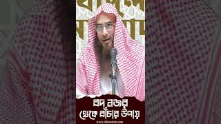 বদনজর/কুদৃষ্টি থেকে বাঁচার উপায় •শায়খ মতিউর রহমান মাদানী #ytshorts 1 #Waz #sunnah