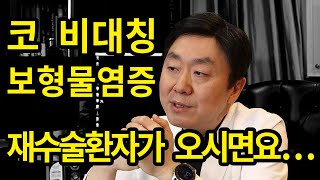 코수술후 코 비대칭,코수술 보형물 염증 등 흔히 볼수 있는 코재수술.