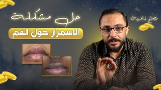 الحل النهائي لازالة السواد والاسمرار حول الفم والشفايف في ايام ..