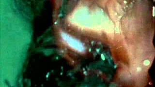 Stan Brakhage - Dog Star Man: Part III [1964]