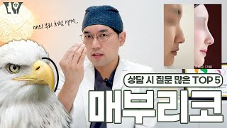 상담 시 질문 많은 매부리코 TOP 5!